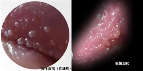 图片细节说明